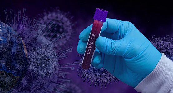 Russia will send additional 50 thousand coronavirus  tests to Kazakhstan