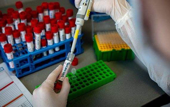 В Нур-Султане заражению коронавирусом больше подвержены лица от 30 до 49 лет – УОЗ
